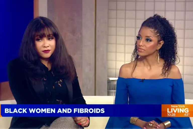 Read more about the article Empowering Black Women: A Holistic Approach to Managing Fibroids Naturally